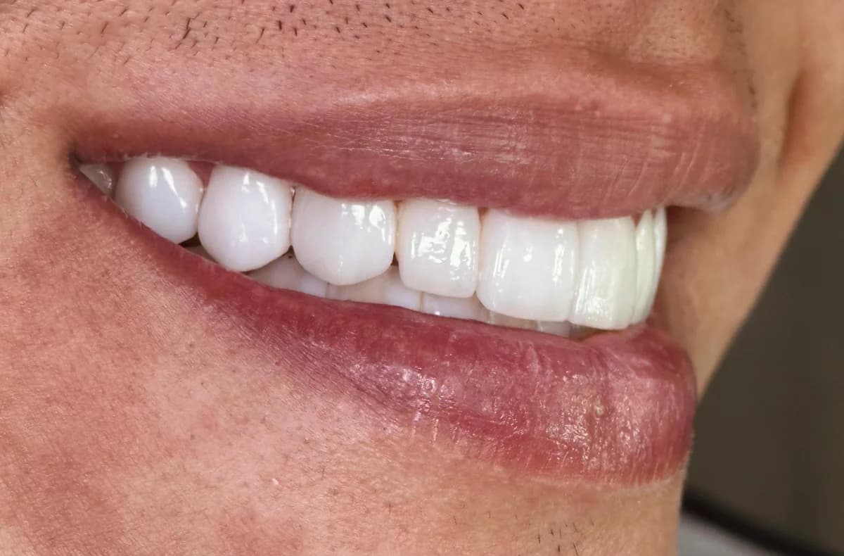 Pacientes felices con su nueva sonrisa (1)