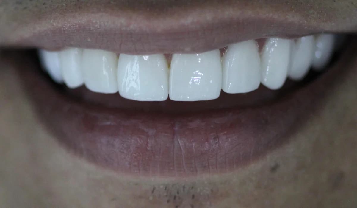 Pacientes felices con su nueva sonrisa (10)