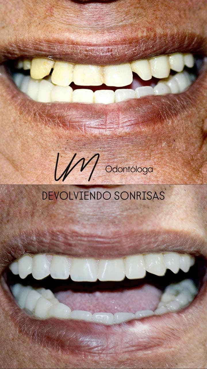 Pacientes felices con su nueva sonrisa (11)