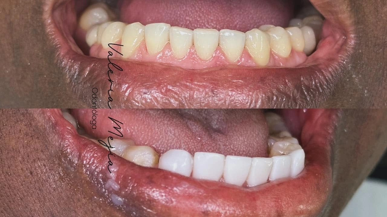 Pacientes felices con su nueva sonrisa (13)