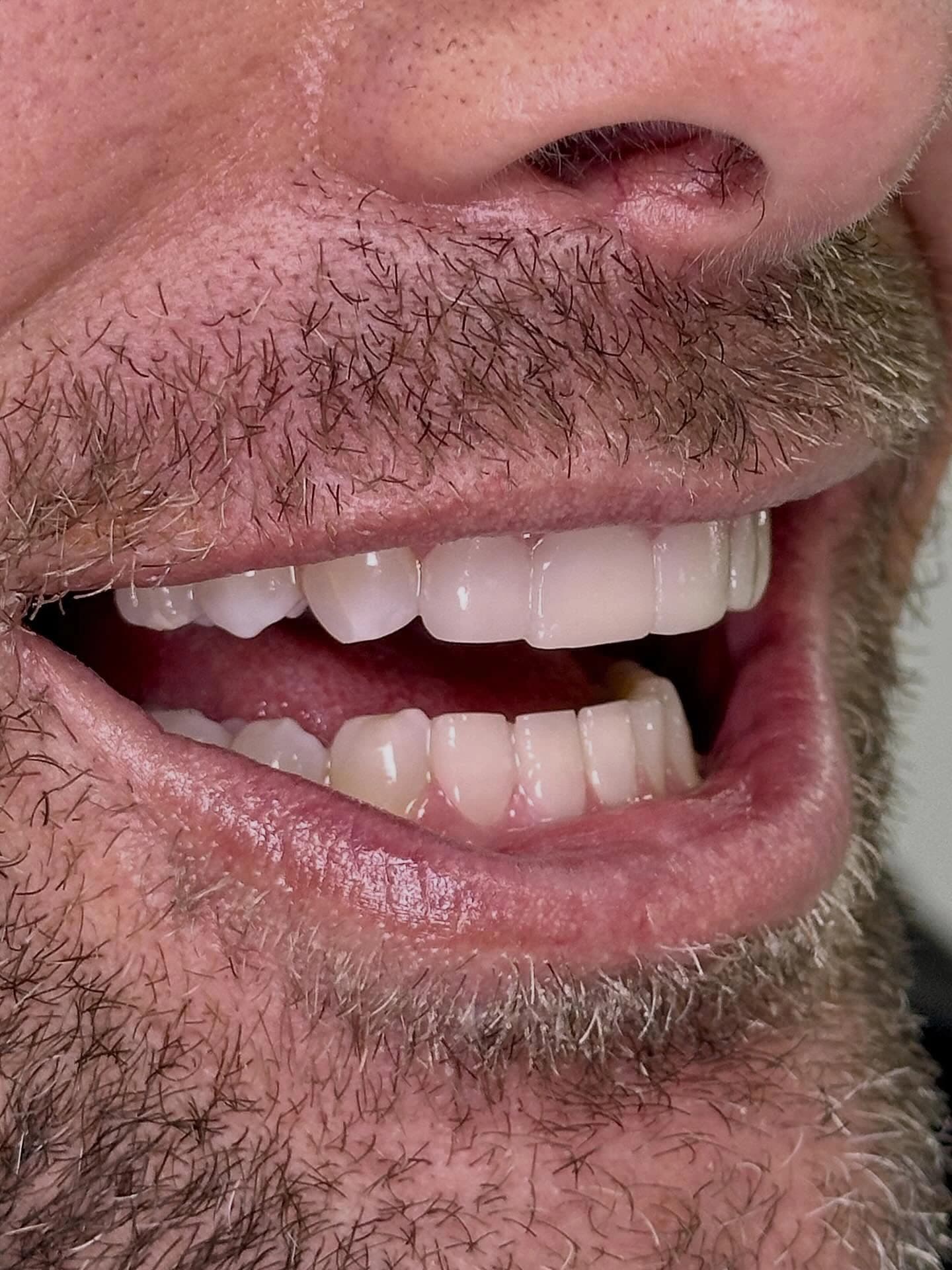 Pacientes felices con su nueva sonrisa (3)