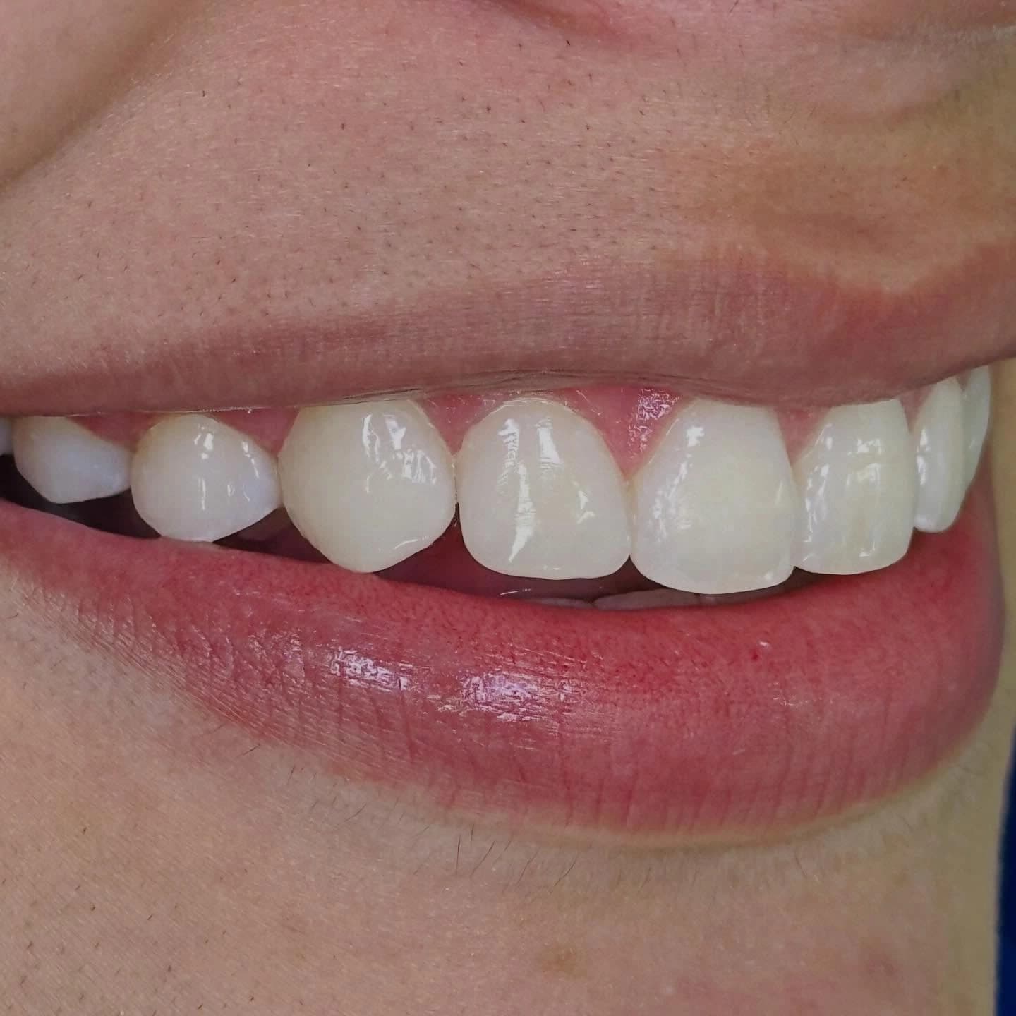 Pacientes felices con su nueva sonrisa (5)