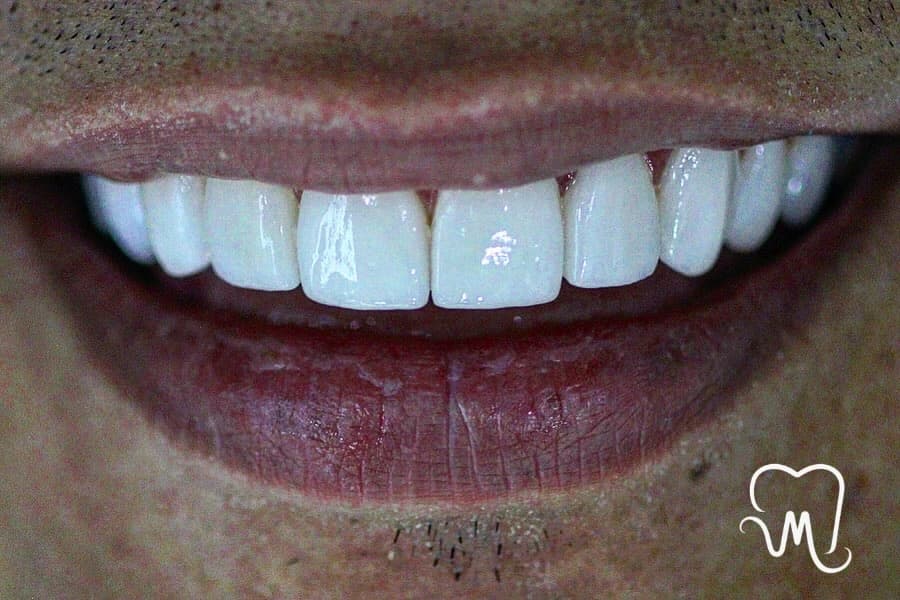 Pacientes felices con su nueva sonrisa (6)