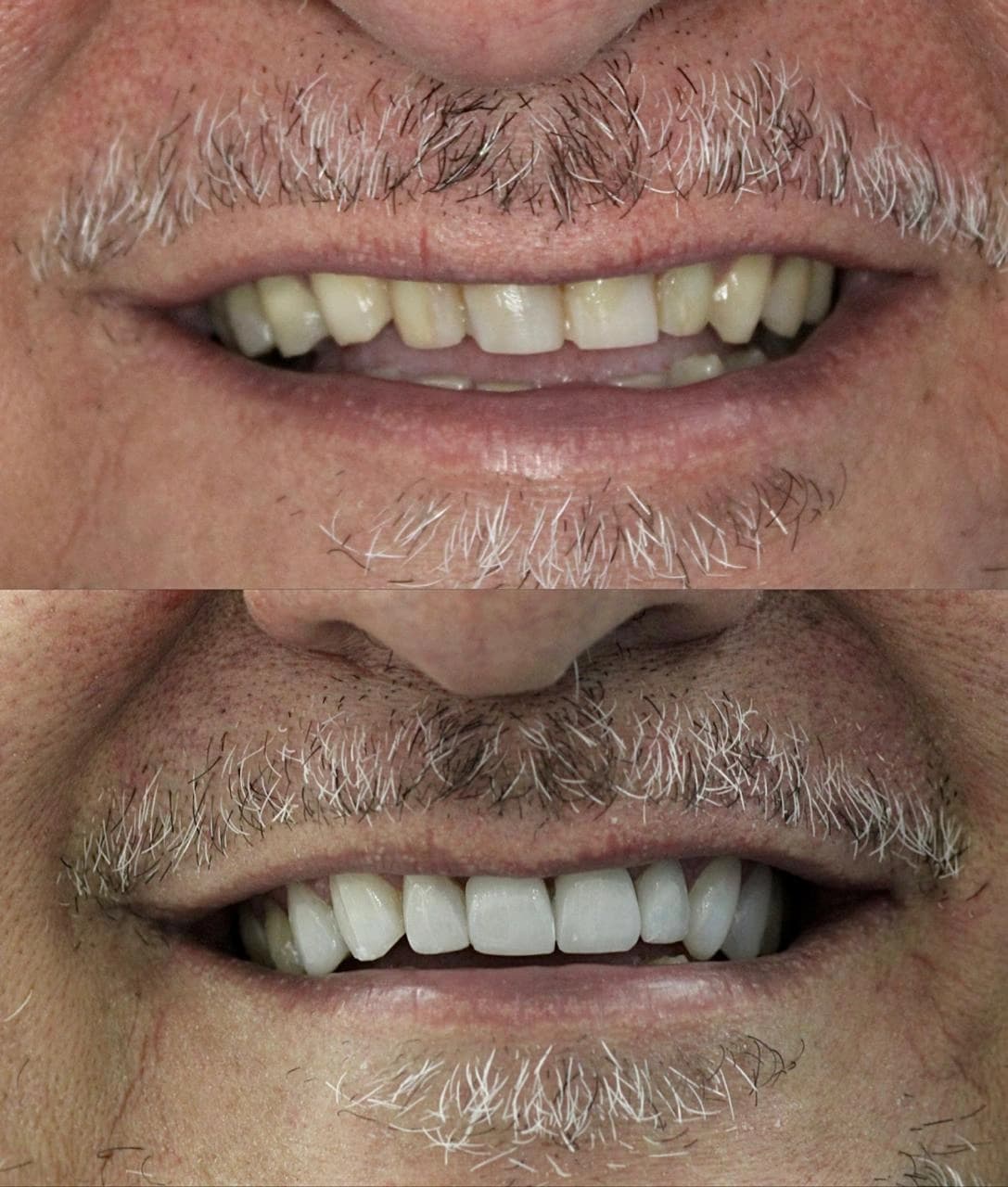Pacientes felices con su nueva sonrisa (8)